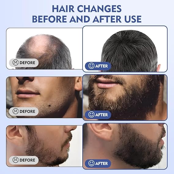 Derma Stamp Micro Needling Tool .