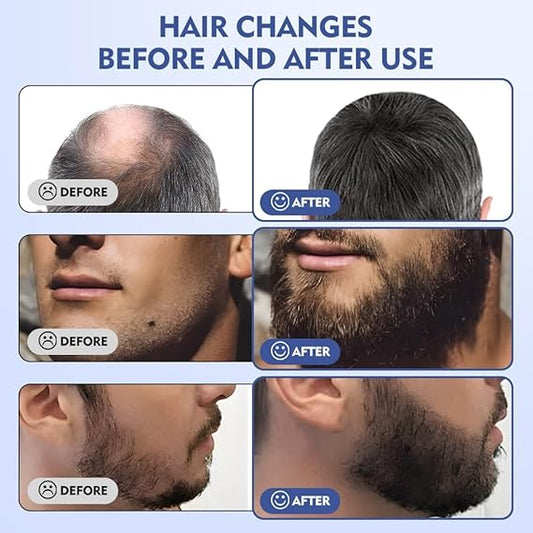 Derma Stamp Micro Needling Tool .