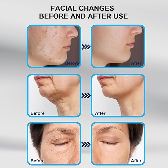 Derma Stamp Micro Needling Tool .