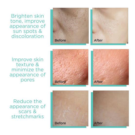 Derma Stamp Micro Needling Tool .